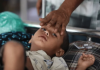 Eight More Children Die in Bangladesh from Measles and Related Infections, Death Toll Rises to 639